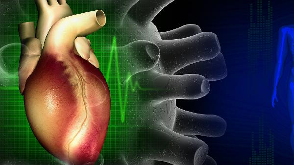 前壁心肌梗死的症状和原因