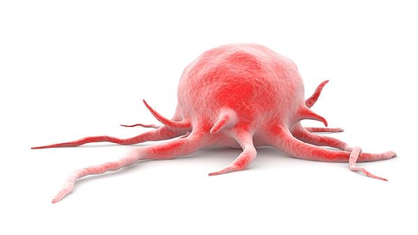 肿瘤五项只有CA199偏高49.4怎么回事 怎么办