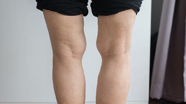 婴儿痉挛症有什么症状 浅析婴儿痉挛症的三个症状