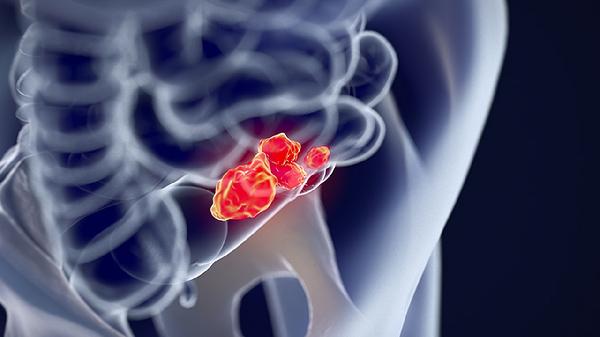 小儿脑囊肿怎么回事 当心导致小儿脑囊肿的两个病因