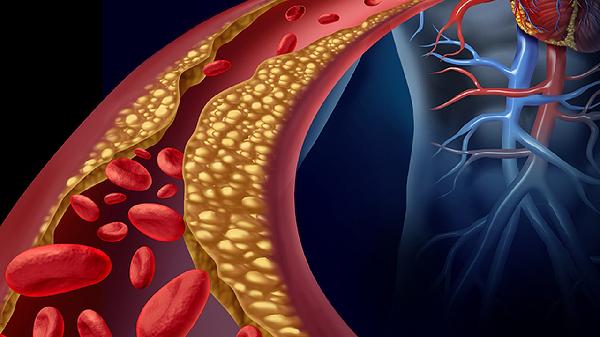 医生告诫:只要血液检测这3个指标异常 千万要重视 别不当回事
