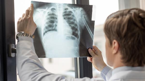 脊柱CT检查什么