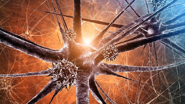 手麻是末梢神经炎吗 末梢神经炎的几个典型症状很受罪