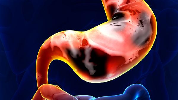 两癌筛查后说要复查怎么回事