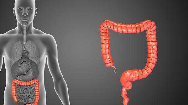 先天性肠闭锁手术的风险性大吗