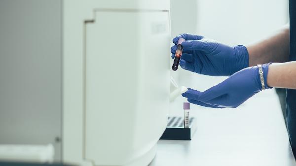 黑便可以采取哪些影像学检查