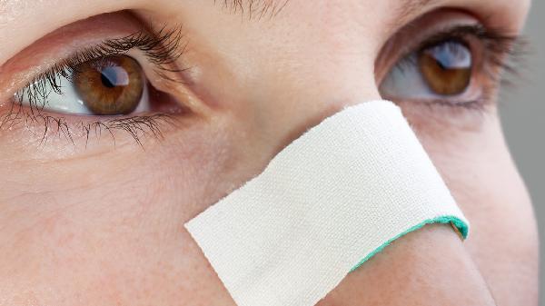 起眼屎是什么原因 吃什么药