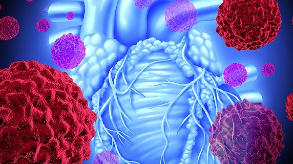 肿瘤上身时 这些异常会开始“显现” 要多留心 别不当回事