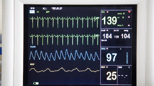 什么是室性并行心律