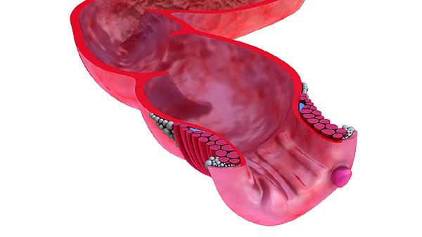脑血管硬化严重吗 脑血管硬化暗藏五大危害