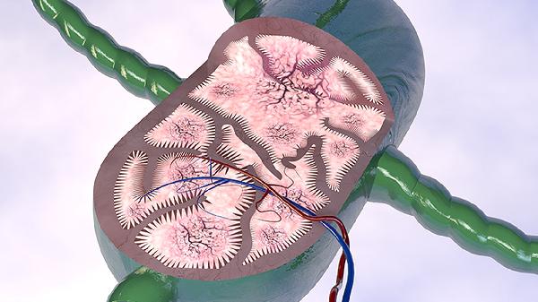 脑血管堵塞怎么查出来
