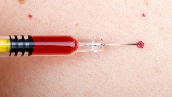 蛛网膜下腔出血严重吗 蛛网膜下腔出血4大并发症很严重