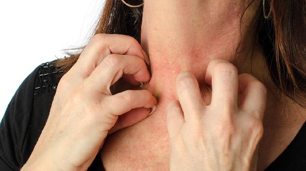 系统性的红斑狼疮+四分是什么意思