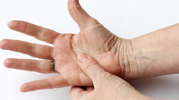 怎么判断腱鞘囊肿 判断腱鞘囊肿的两个方法揭晓