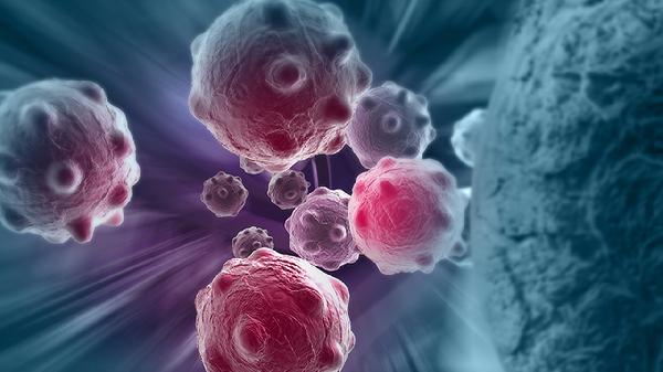 hpv52轻度感染要紧吗