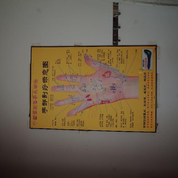 颈部淋巴结肿大可以针灸吗 针灸这些穴位可改善颈部淋巴结肿大