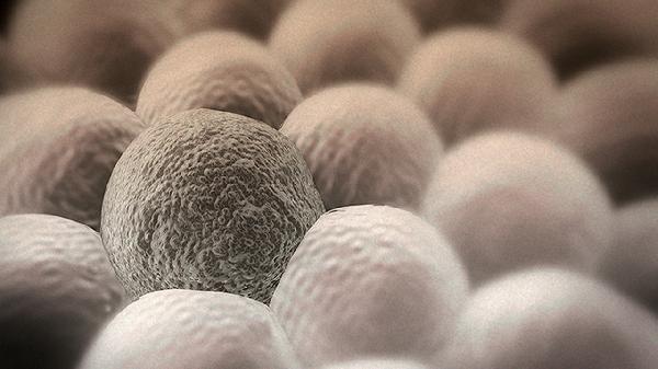 原位鳞状细胞癌是什么意思