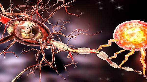 股外侧皮神经炎严重后会怎样 股外侧皮神经炎严重后果剖析