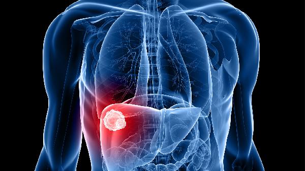 肝硬化晚期疼痛如何缓解 肝硬化晚期疼痛的3个有效缓解方法分享