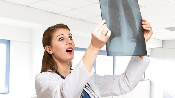 绒毛膜癌转移肺部有何症状