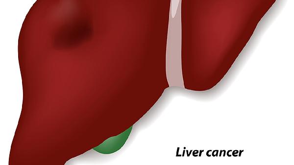 哪三种口腔黏膜疾病容易癌变