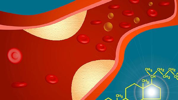 身体有4个表现 要注意 脑溢血或许就藏在背后 及时就医不能拖