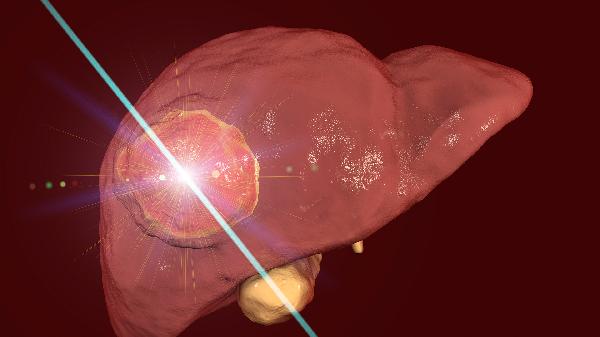 总胆固醇5.74算不算高