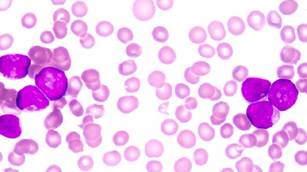 中性细胞比率偏高、淋巴细胞低怎么回事